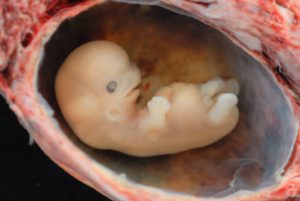 Photograph of an embryo at a gestational age of approximately 8 weeks