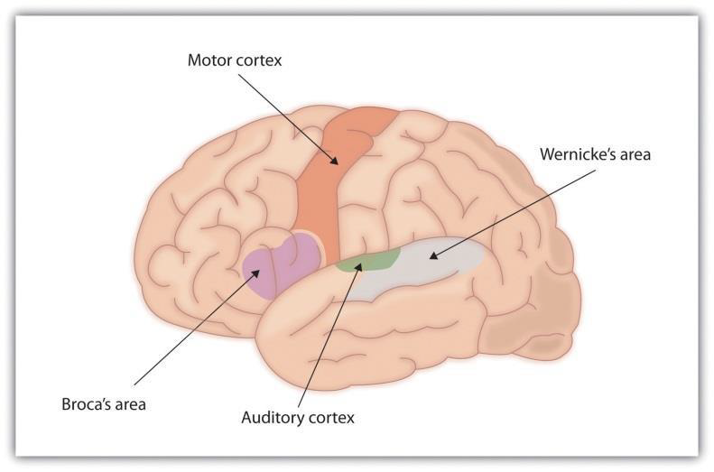 A diagram of the brain depicting Broca's area, Wernike's area, the motor cortex, and auditory cortex